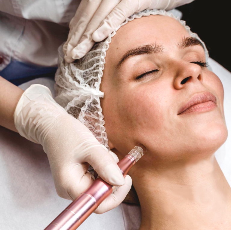 Dermapen facial